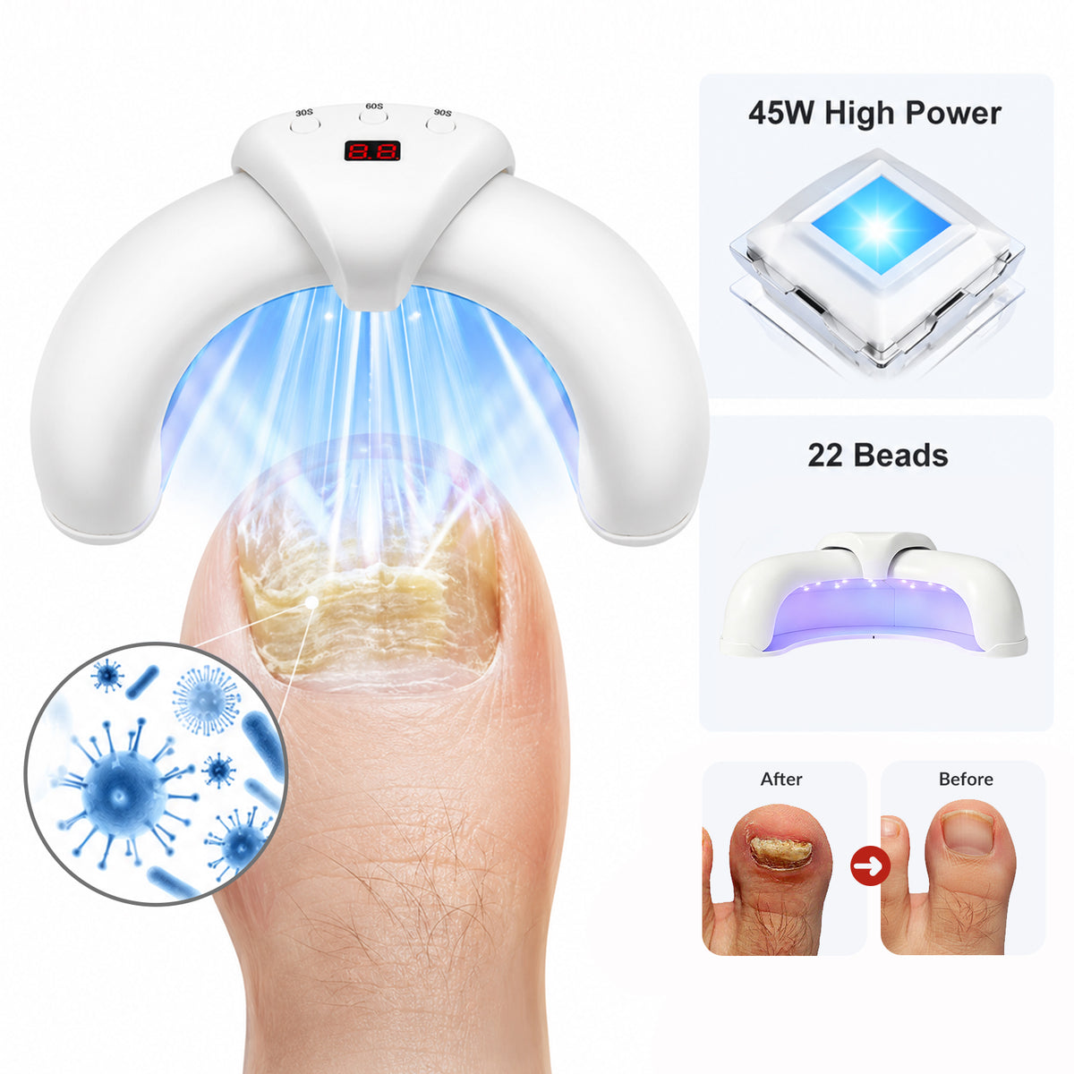45W 905nm Foldable Nail Fungus Treatment Device 22 LEDs