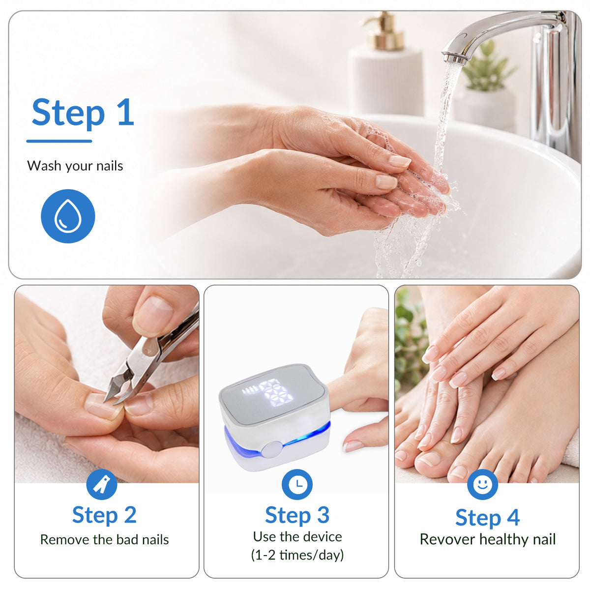 Toenail Fungus Treatment Device | 940nm IR + 500nm Blue Light
