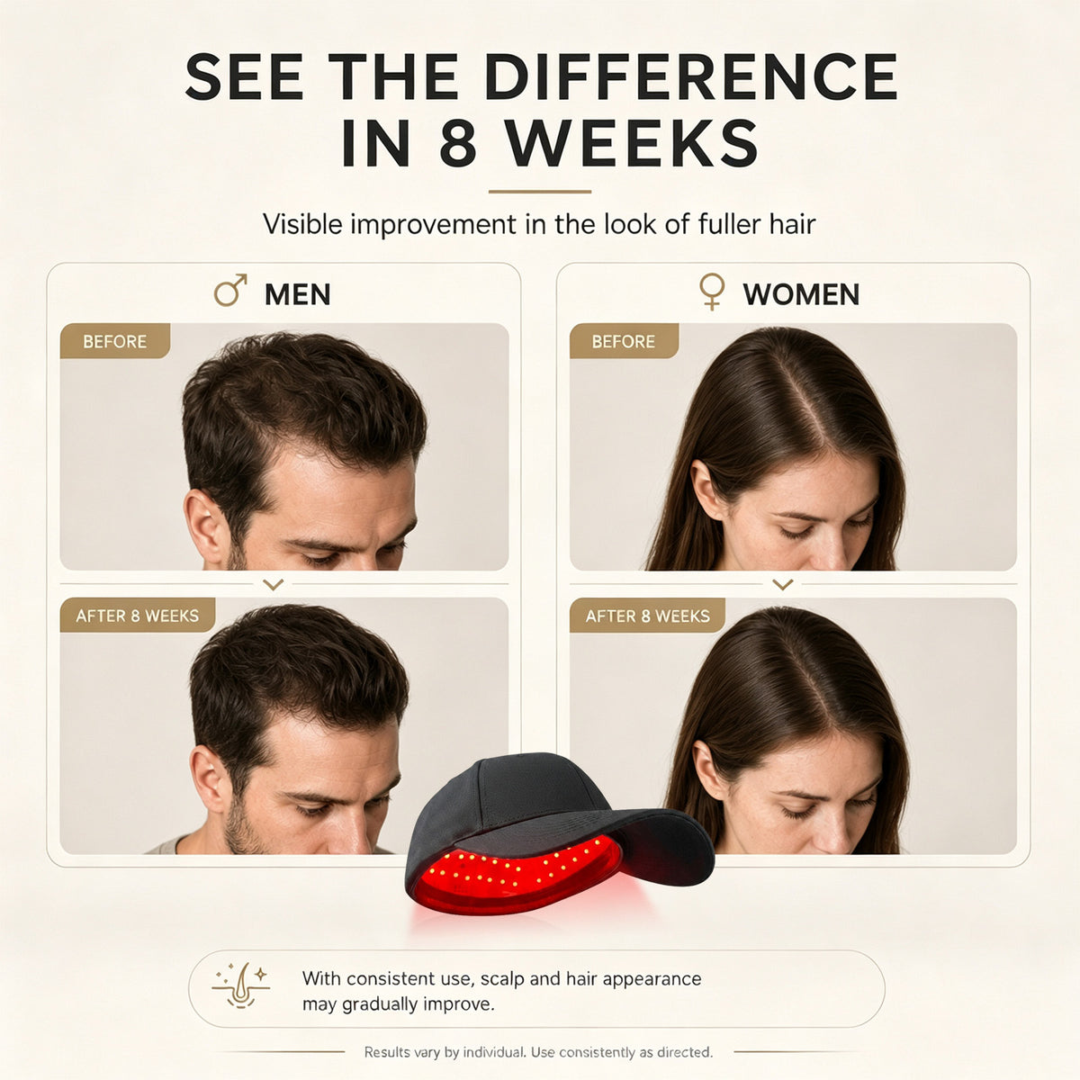 660nm 850nm Red Light Laser Hair Growth Therapy Cap